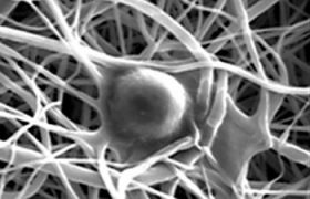 电纺纤维的例子