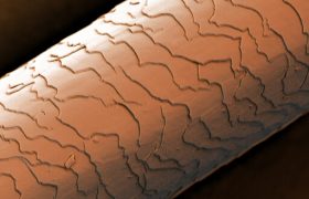 彩色扫描电子显微镜下头发图像